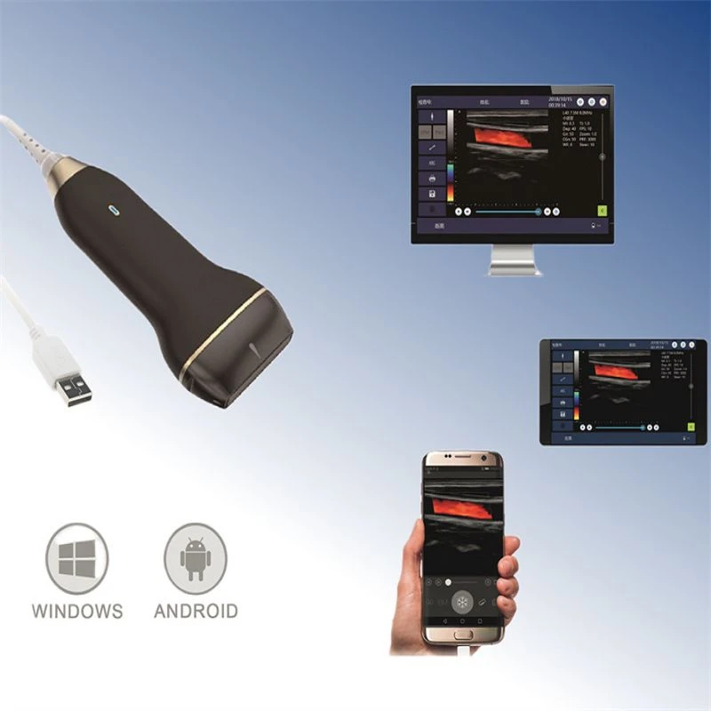 Handheld Color Doppler