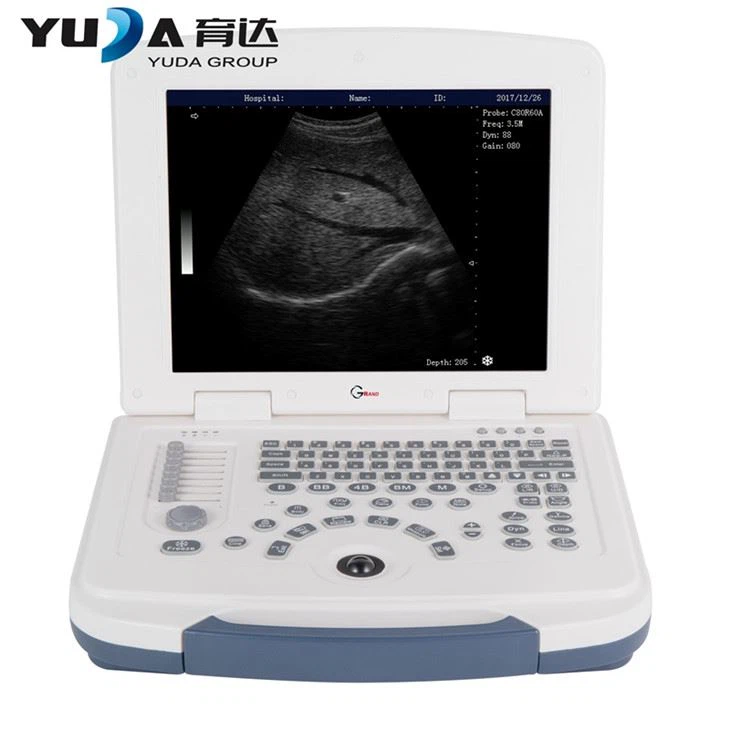 Uwchsain Du a Gwyn Cludadwy'r Gliniadur